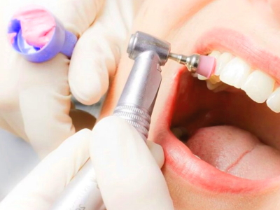 Ремонт стоматологического оборудования - наконечники