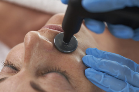 Применение апппарата Indiba Deep Care Elite NS на лице.