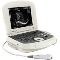 Acuvista VT98c Аппарат УЗИ