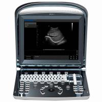 Chison SonoTouch 10 Аппарат УЗИ