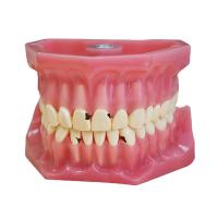 ЧВН-32К - денто-модель верхней и нижней челюстей для практики лечения кариеса