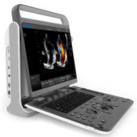 Chison SonoTouch 60 Pro Аппарат УЗИ