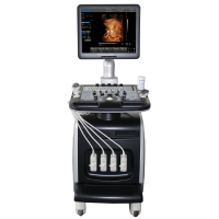 Chison i8 Аппарат УЗИ