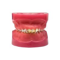 ЧВН-24П - денто-модель детской челюсти с патологиями