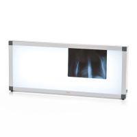 Негатоскоп общего назначения трехкадровый