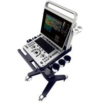 Chison SonoTouch 60 Аппарат УЗИ