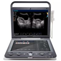 Sonoscape S9 Vet Аппарат УЗИ