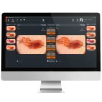 FotoFinder Moleanalyser Pro Дерматоскоп