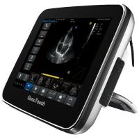 Chison SonoTouch 30 Аппарат УЗИ