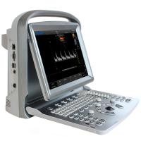 Chison SonoTouch 50 Аппарат УЗИ