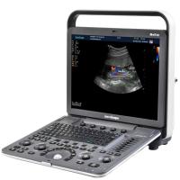 Sonoscape S8 Exp Аппарат УЗИ