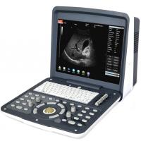 Acuvista RS880d Аппарат УЗИ