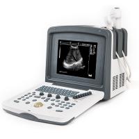 Acuvista VT880p Аппарат УЗИ
