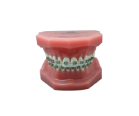 ORTHODONTIC A - фантомная челюсть, демонстрационная модель с брекетами