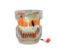TOOTH MODEL P-TYPE - прозрачная демонстрационная модель челюсти