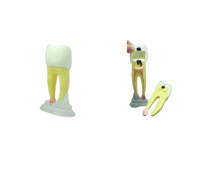 TOOTH MODEL R-TYPE - разборная модель зуба