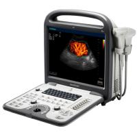 Sonoscape S6N Аппарат УЗИ