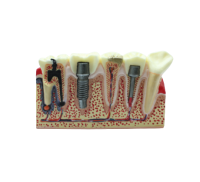 STF MODEL - демонстрационная модель