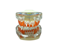 TOOTH MODEL F-TYPE - прозрачная модель, демонстрирующая прорезывание зубов