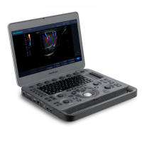 Sonoscape S2N Аппарат УЗИ