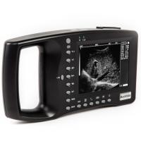 Acuvista VT880b Аппарат УЗИ