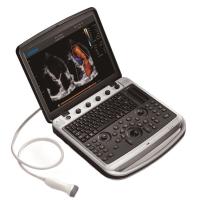 Chison SonoTouch 80 Expert Аппарат УЗИ