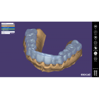 Exocad Bite Splint Module - модуль для создания терапевтических капп