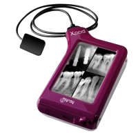 X-pod - беспроводная цифровая радиовизиографическая система