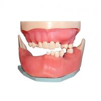 МУ0363 - денто-модель для хирургической практики