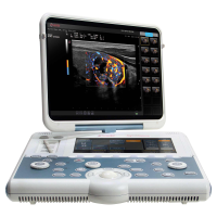 Esaote MyLab Gamma Аппарат УЗИ