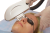 Beijing Toplaser Technology Soft Light W Skin Косметологический лазер Beijing Toplaser Technology Soft Light W Skin Косметологический лазер