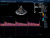Mindray DC-8 Exp Аппарат УЗИ Mindray DC-8 Exp Аппарат УЗИ
