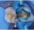 Smile Lite MDP - подсветка для дентальной фотографии, для смартфона Smile Lite MDP - подсветка для дентальной фотографии, для смартфона