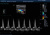 Mindray DC-8 Exp Аппарат УЗИ Mindray DC-8 Exp Аппарат УЗИ