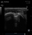 Healcerion Sonon 300C Аппарат УЗИ Healcerion Sonon 300C Аппарат УЗИ