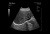 Healcerion Sonon 300C Аппарат УЗИ Healcerion Sonon 300C Аппарат УЗИ