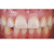 Smile Lite MDP - подсветка для дентальной фотографии, для смартфона Smile Lite MDP - подсветка для дентальной фотографии, для смартфона